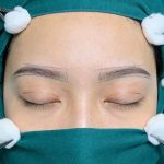 深圳割双眼皮整形医院哪里好？割双眼皮整形医院如何选择？