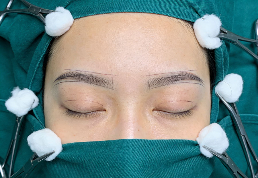 深圳割双眼皮整形医院哪里好？割双眼皮整形医院如何选择？