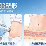 杭州吸脂多少钱？杭州吸脂塑形如何选择医院？