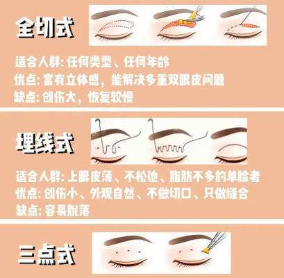 卢建建双眼皮修复价格贵不贵？技术怎么样？真实口碑测评插图3