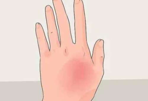 上海九院林晓曦医生激光美容怎么样？附医生简介及技术亮点插图2