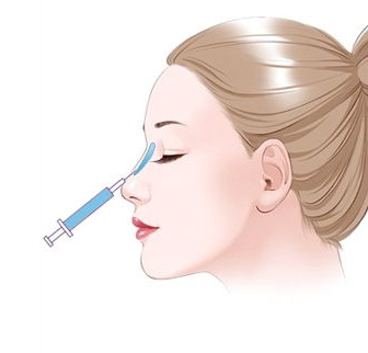 西安刘翔宇医生做鼻子怎么样？核心技术与审美解析，附真实案例参考插图