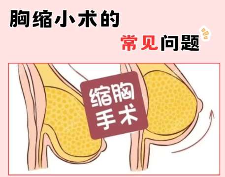 王希润医生口碑怎么样？胸部整形医生推荐 | 青岛大学附属妇女儿童医院插图3