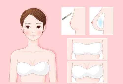 陈宝贵医生怎么样？胸部整形医生推荐 | 维密插图1