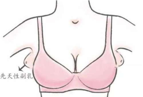 朱珂医生怎么样？胸部整形医生推荐 | 亚太医院插图3