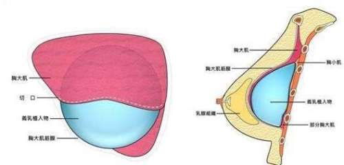 陈翔凌医生怎么样？插图3