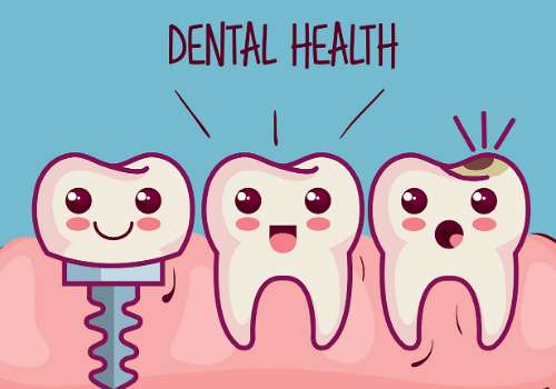 成都种植魏娜医生怎么样？价格透明+技术先进，本地人推荐的靠谱选择插图1