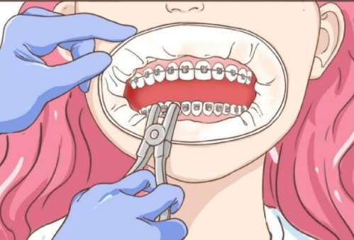 上海正畸全孝华，具体资料分析+专科特色解析插图2