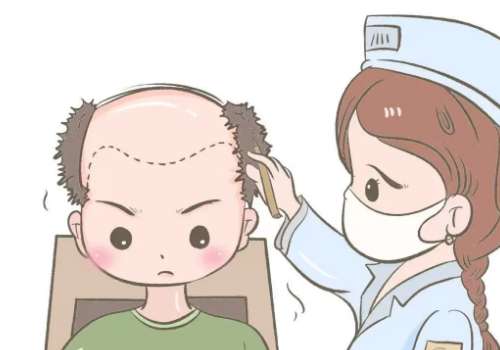 南宁植发医院植发价格多少？8000元起，价格明细与口碑医院选择指南请收好插图