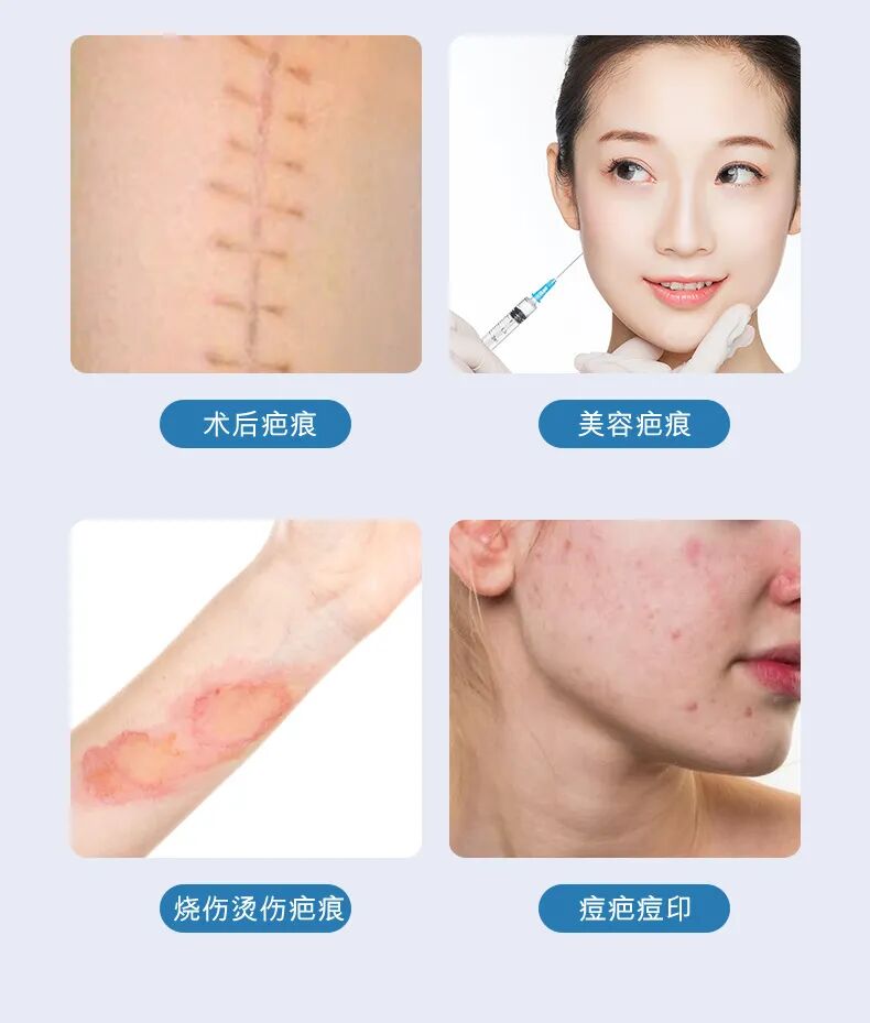 长沙哪个医院祛疤最好?本地人推荐这几家插图