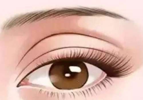 郭宗科双眼皮贵吗?东南大学附属中大医院专家收费参考插图