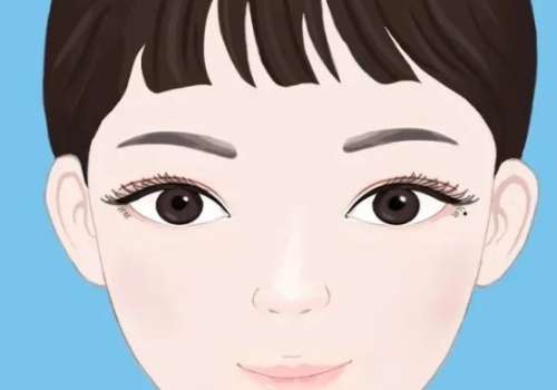 哈医大祝仰东做双眼皮怎么样？哈尔滨医美圈反馈：技术稳，闭眼痕迹淡插图4