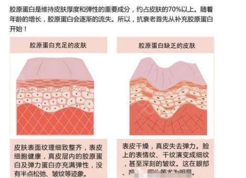 2026北京胶原蛋白填充医院排名口碑名单披露！医生实力与价格对比插图