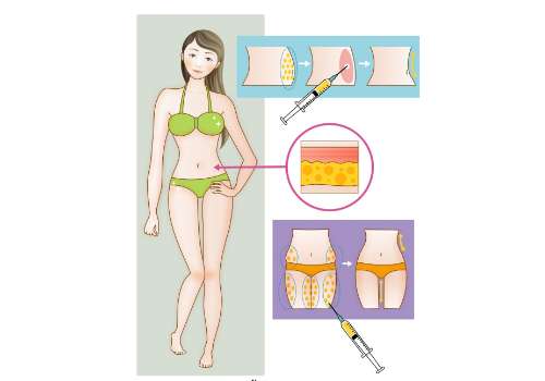 蒲小兵院长抽脂怎么样？经验丰富_手法稳_审美自然！术后满意度高！插图3