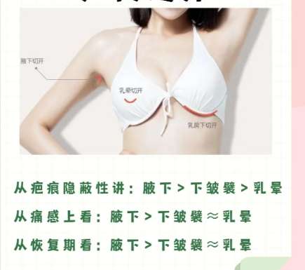 王海涛医生怎么样？胸部整形医生推荐 | 太原欧美莲医院插图3