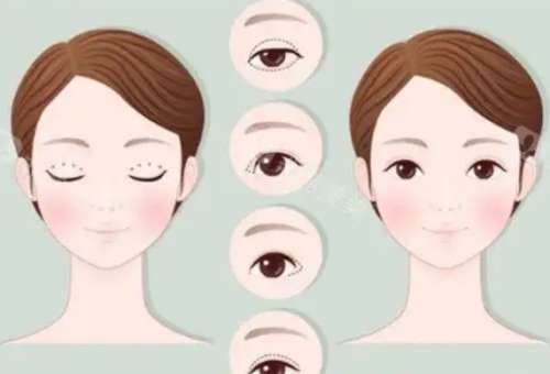 林仙保医生个人简历介绍！网友做眼部整形案例图反馈！插图2