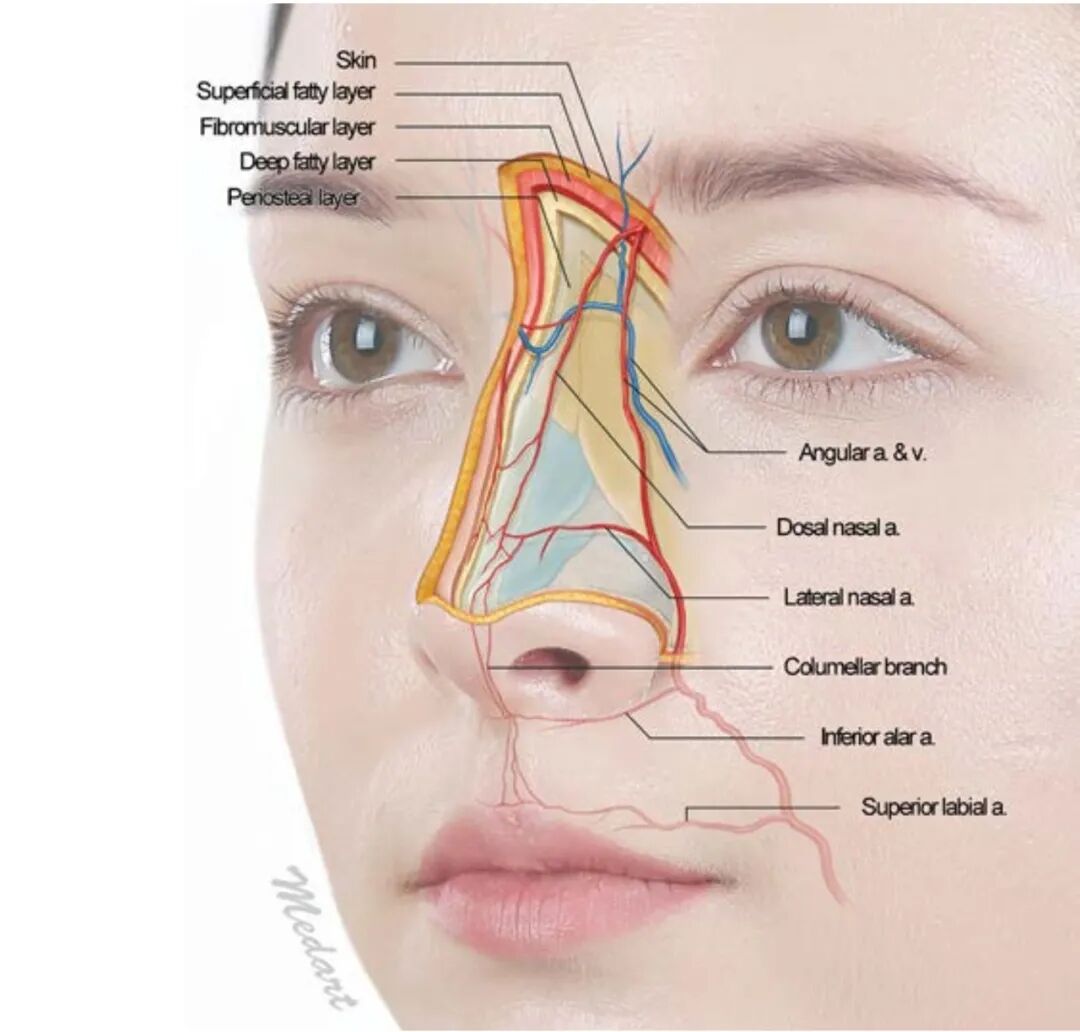 玻尿酸隆鼻要多少钱？2026年最新费用清单插图