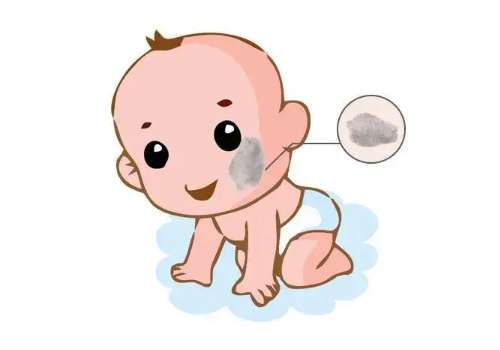 上海九院陈辉和罗旭松谁手术做胎记好？2026技术比拼、各有千秋！插图1