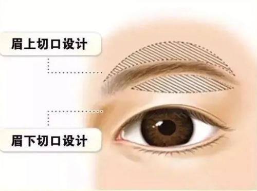 武汉协和医院提眉医生排名！热门专家盘点，技术优势与价格参考插图