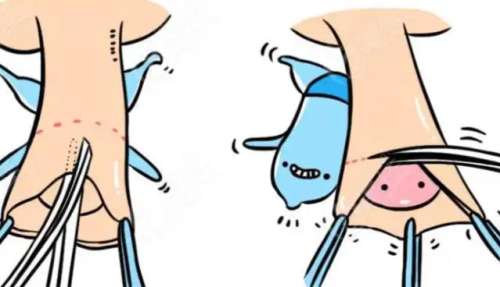 延长增粗手术郭建华医生和李世荣医生谁厉害？技术实力与口碑全面PK插图1