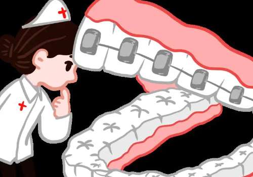 上海正畸张蕾医生介绍！对手法、技术等多个方面进行了分析插图1