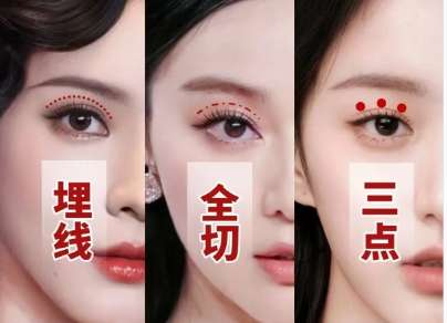 毛林医生口碑怎么样？胸部整形医生推荐 | 美添天合美邦插图1