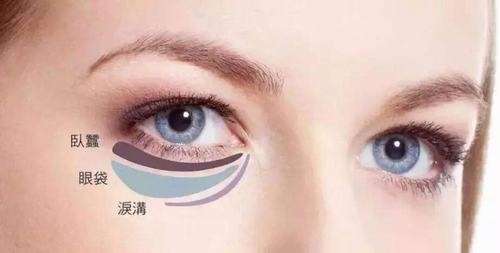 杨世界医生做眼袋手术怎么样？个性化定制、疤痕隐藏、注重眼周年轻化插图