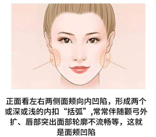 沈开生医生怎么样?医莱新美思医疗美容脂肪整形插图3 沈开生医生怎么样?医莱新美思医疗美容脂肪整形插图3