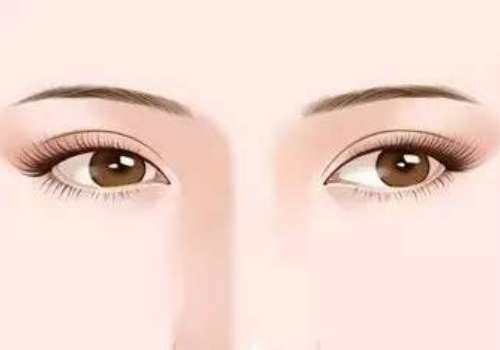 王法刚双眼皮案例分享！告诉你自然度+性价比，坐诊山东省立医院！插图1