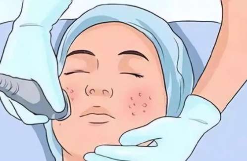 贵州人民医院整形科坐诊医生一览！唐修俊、龙艳、李丰等技术在线！插图4