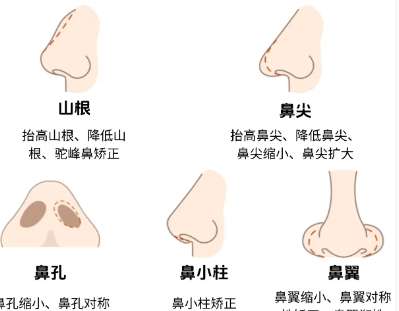 广州颜玲做鼻子如何？在哪里坐诊？医生简介|网友案例亲测插图3