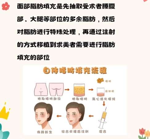 陈万芳医生怎么样?联合丽格脂肪整形推荐插图1 陈万芳医生怎么样?联合丽格脂肪整形推荐插图1