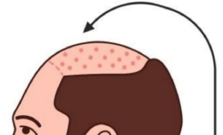 上海植发王志勇 · 医生简介、技术特点、收费价格参考插图2