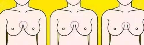 石正平医生怎么样-胸部整形-乌鲁木齐华美整形插图2