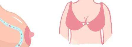 付学成医生怎么样？胸部整形医生推荐 | 济南华韩插图4