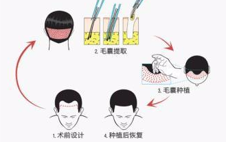 杭州张菊芳个人资料简介-发际线种植风格-2026年最新价目表流出插图1