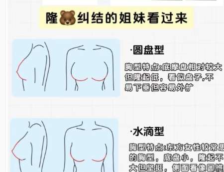 杨文敬医生怎么样？胸部整形医生推荐 | 烟台壹美天成医院插图4