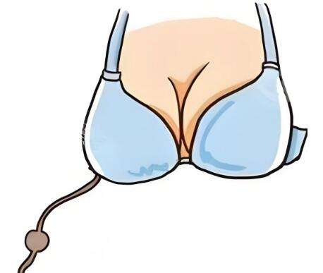 赵雷医生口碑怎么样？胸部整形医生推荐 | 昆明时光专注吸脂塑型插图2