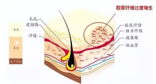 成都何珊珊医生怎么样？擅长精细化眼部整形，术后恢复快插图2