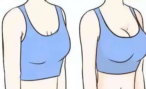 杨文敬医生怎么样？胸部整形医生推荐 | 烟台壹美天成医院插图2