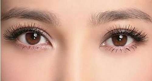 吴焱秋修复到底好不好？技术好，擅长项目：双眼皮修复、初次双眼皮手术…插图1