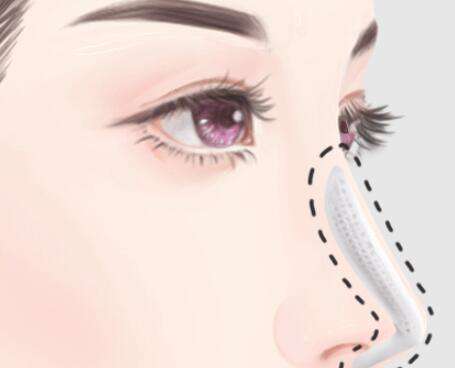 南方医院打瘦脸找哪位医生？口碑好的医生名单曝光了插图1