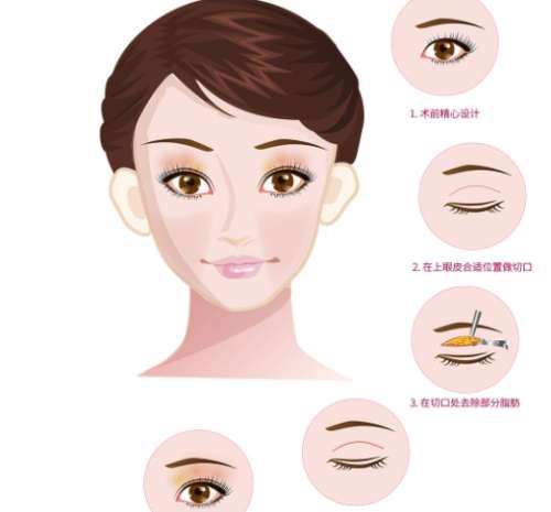 南昌一附院整形科哪个医生好？文辉才、卢颖洁技术特色对比！插图4