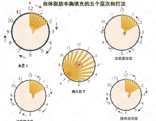 白金庄医生口碑怎么样？胸部整形医生推荐 | 武汉星月汇医疗美容医院、武汉阿芙罗医疗美容医院院插图1