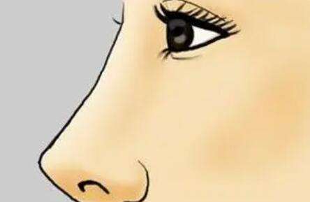 刘志刚医生口碑怎么样？鼻部整形医生推荐 | 中家医插图1