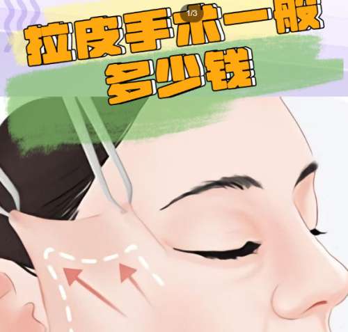北京陈凤超拉皮手术技术怎么样？医生资质点评！含价格插图3