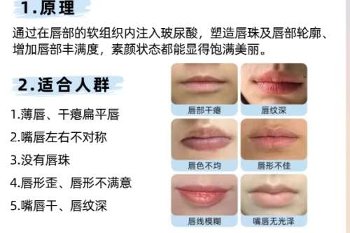李文鹏医生怎么样?杭州连天美脂肪整形插图2 李文鹏医生怎么样?杭州连天美脂肪整形插图2