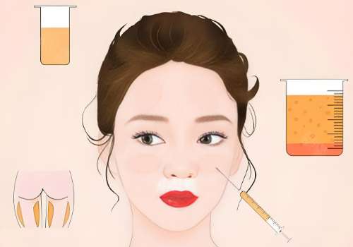 上海丽铂杜银燕脂肪填充好吗？透明定价，拒绝套路插图2