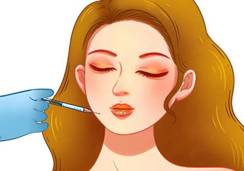 广州脂肪填充医生曾繁茂怎么样？技术沉稳、审美在线！附价格明细插图1