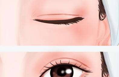 任正义医生口碑怎么样？眼部整形医生推荐 | 医美信医疗整形美容插图1